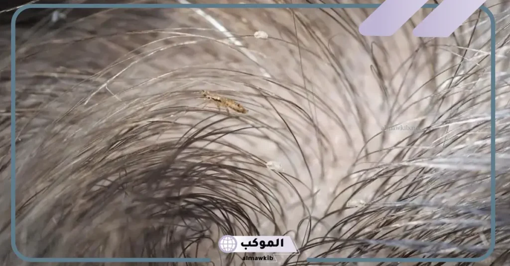 رؤية القمل في المنام للعزباء 