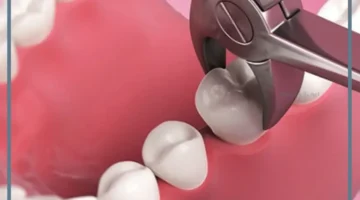 حلم خلع سن للبنت