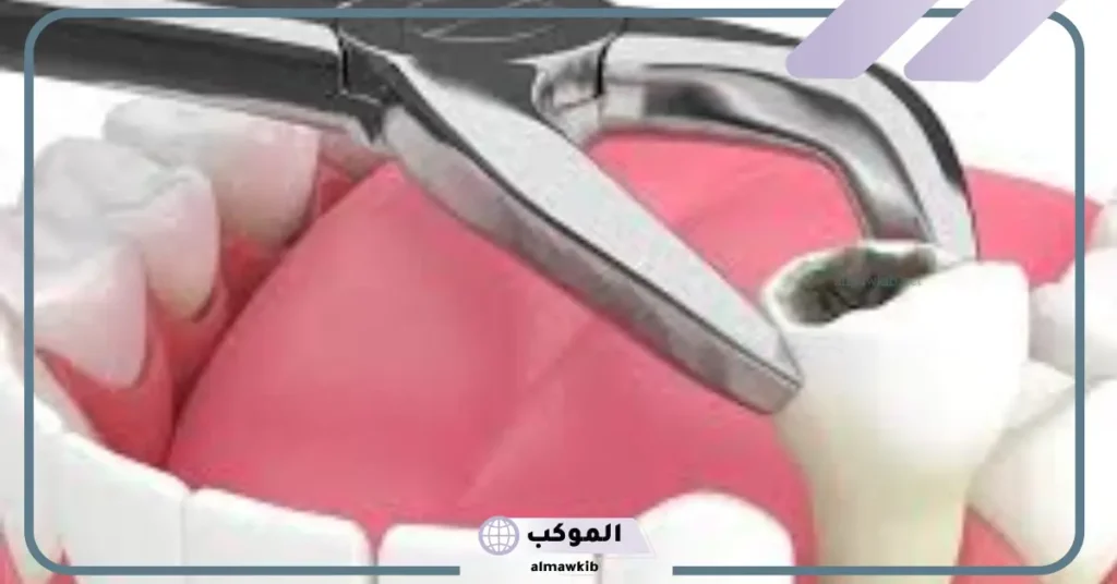 تفسير حلم خلع السن في المنام للمتزوجة والمطلقة عند ابن سيرين 6 تفسير حلم خلع السن السفلي باليد للمتزوجة