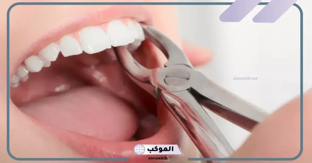 تفسير حلم خلع السن في المنام للمتزوجة والمطلقة عند ابن سيرين 5 تفسير حلم خلع السن باليد بدون ألم للمتزوجة