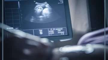 شكل الجنين في الشهر الثالث