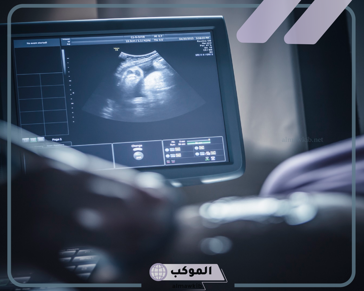 شكل الجنين في الشهر الثالث بالسونار