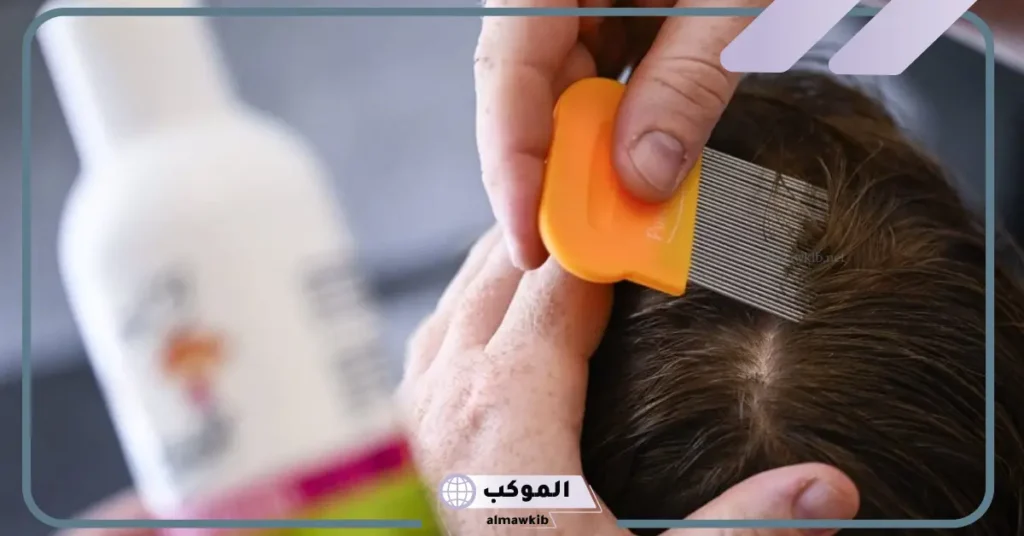 تفسير حلم القمل في الشعر وقتله للعزباء