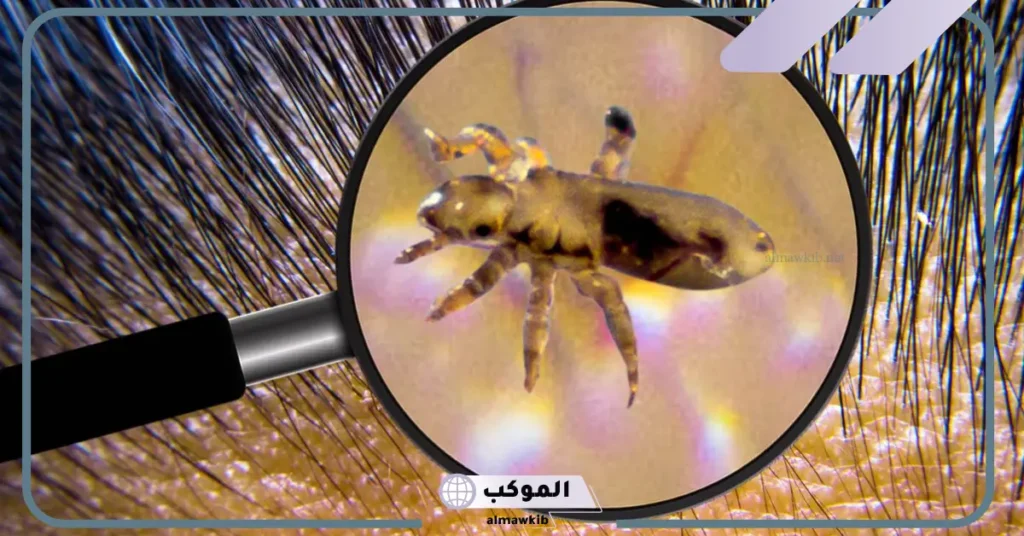 تفسير حلم رؤية القمل في المنام في الشعر للمطلقة والمتزوجة لكبار العلماء 5 رؤية القمل في الشعر في المنام للعزباء