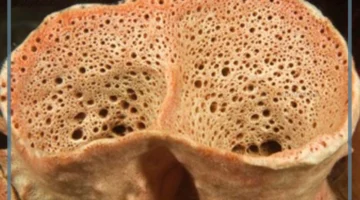 التغذية في الإسفنجيات