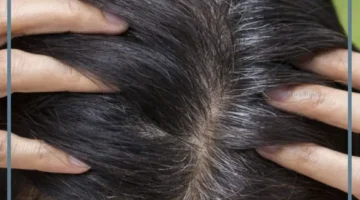 تفسير الشيب في المنام للمتزوجة