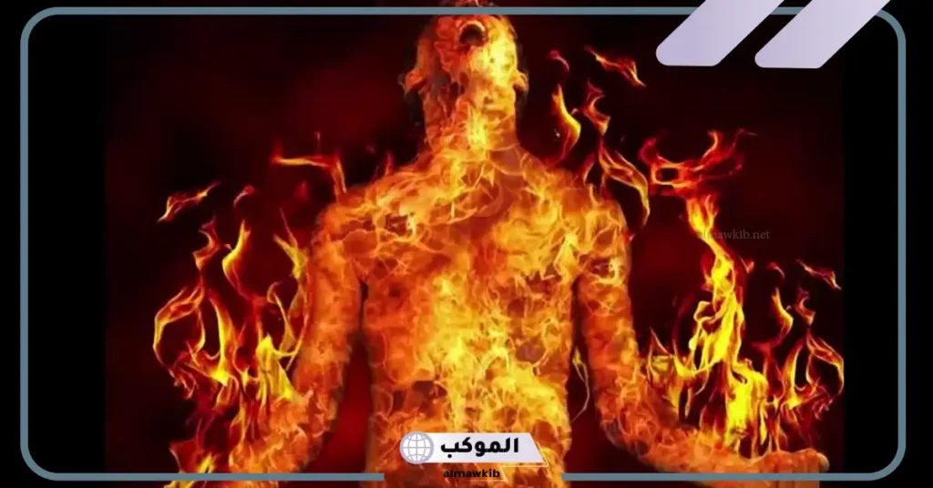 تفسير حلم الحرق في الجسم للعزباء