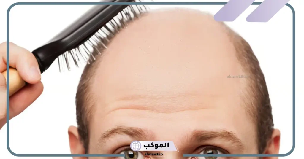 تفسير حلم الصلع للحامل